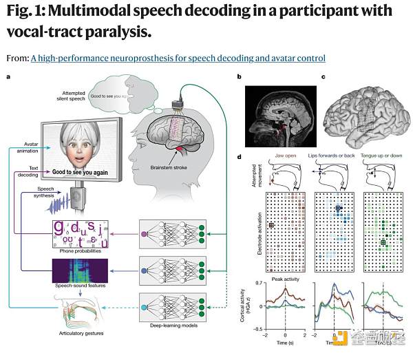 中风瘫痪18年  AI让她再次「开口说话」：脑机接口模拟表情  数字化身当嘴替